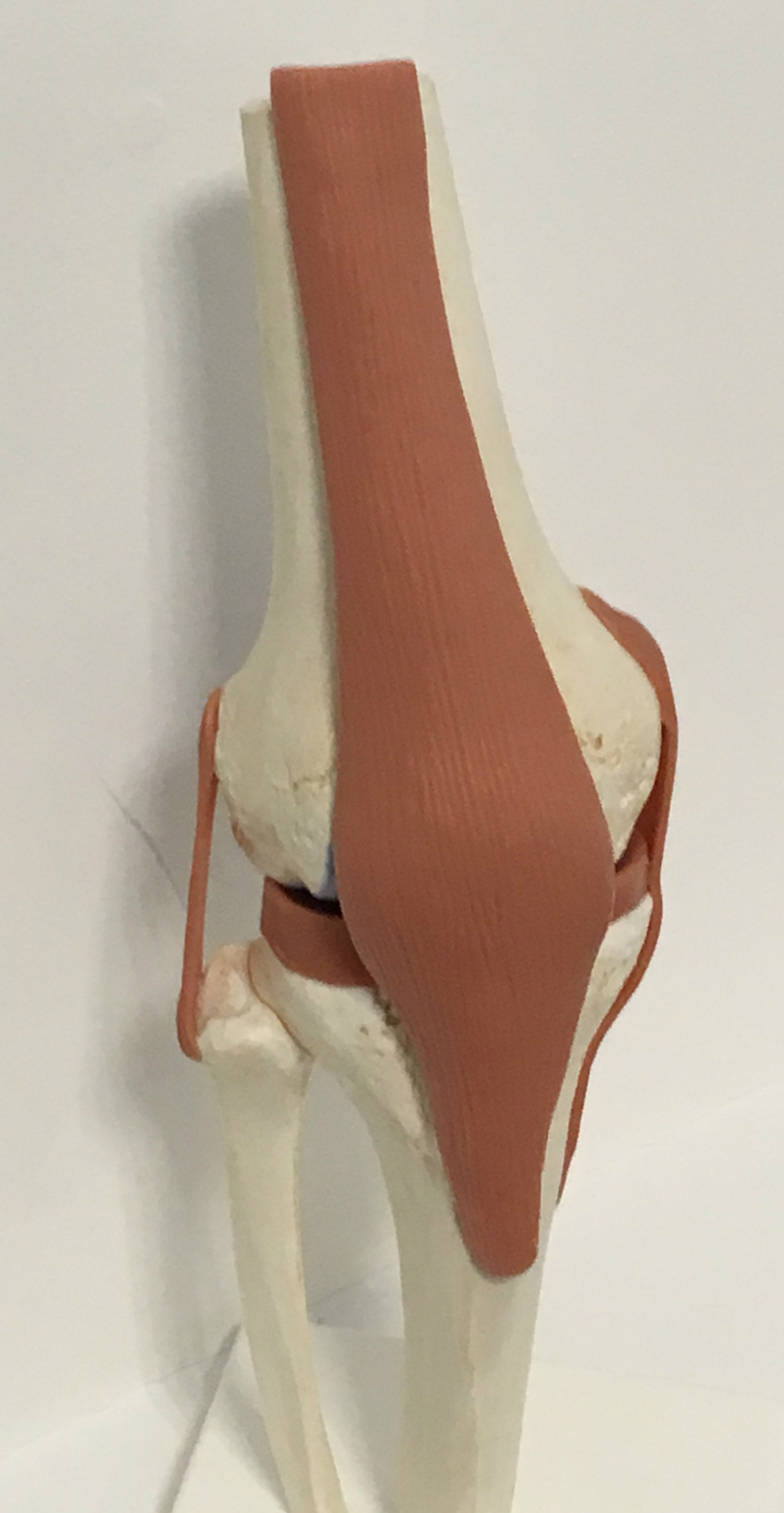 Knie gewricht patello-femoraal pijnsyndroom 